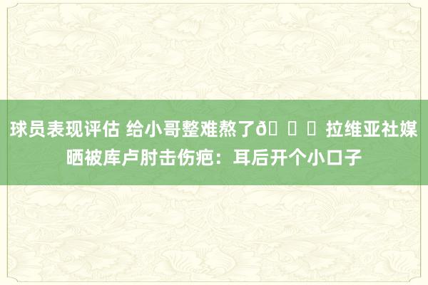 球员表现评估 给小哥整难熬了😅拉维亚社媒晒被库卢肘击伤疤：耳后开个小口子